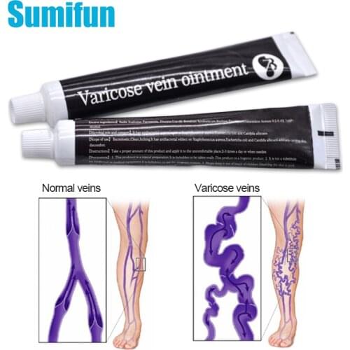 1pcs Varicose Veins Treatment Ointment Varicosity Angiitis Removal Vasculitis Phlebitis Spider Pain Relieving Herbal Plaster