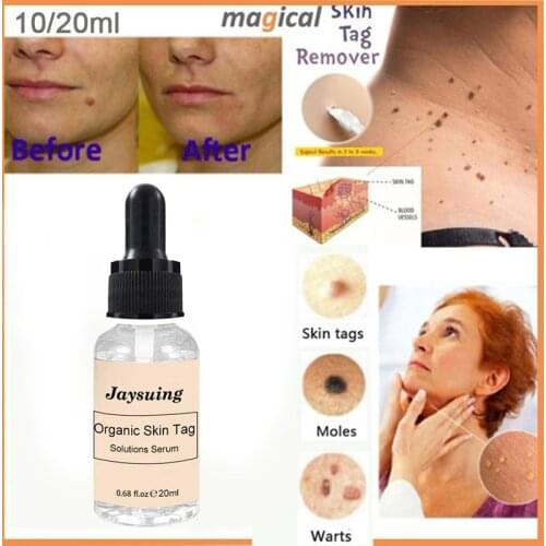 10/20ML Organic Tags Solutions Serum Skin Tag Remover Serum Painless Mole Skin Dark Spot Freckle Remover Cream Oil Plaster