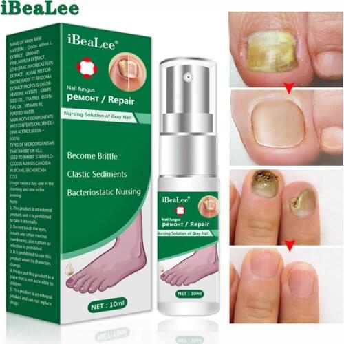 IBeaLee 8PCS Fungal Nail Treatment Feet Care Essence Nails Fungas Foot Repair Nail Fungus Removal Gel Anti Infection Paronychia