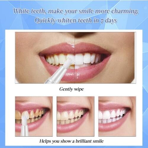 Teeth Whitening Pen Fast Cleaning Remove Plaque Stains Oral Hygiene Tool NN