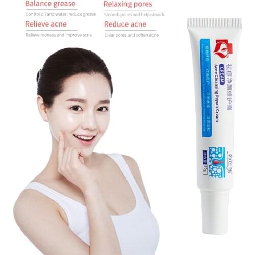 Anti-acne Cream Treatment Cream Blackhead Acne Cream Repair Gel Oil Control Shrink Pores Scar Facial Care Whitening Skin TSLM1