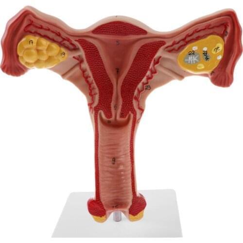 1:1 Human Female Uterus Ovary Fallopian Tubes Model Anatomical human anatomy model medical teaching tools