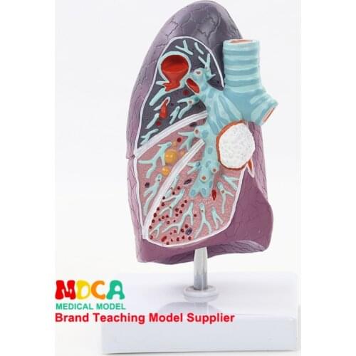 MFB001 Medical Teaching of Pulmonary Structural Models in Respiratory Department of Pulmonary Anatomy