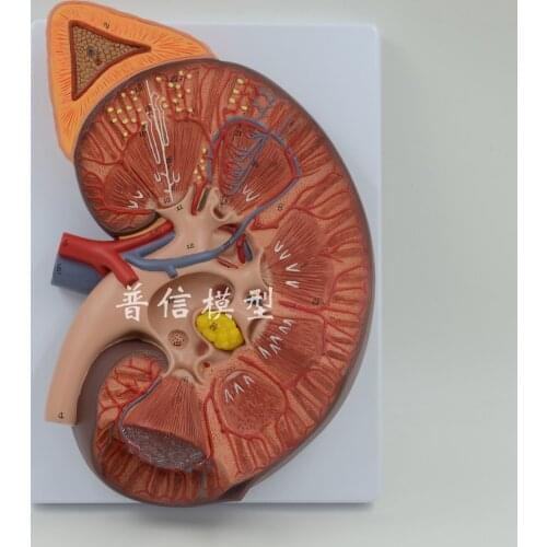 Free shipping&Adrenal gland, renal anatomy,amplify kidney model for urological department, luxurious Renal anatomy model