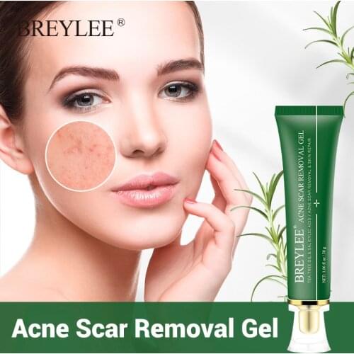 BREYLEE Tea Tree Acne Scar Removal Gel Remove Skin Pigmentation Fade Acne Marks Spots Soothing Skin Repair Oil Control Skin Care