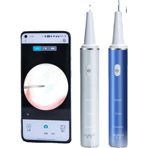 Zq Xiaomi Visual Ultrasonic Teeth Cleaning Machine Household Tooth Stone Removal Remover