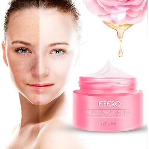 Remove Freckle Cream Skin Whitening Cream Remove Melasma Acne Spot Pigment Melanin Dark Spot Moisturizing Face Cream
