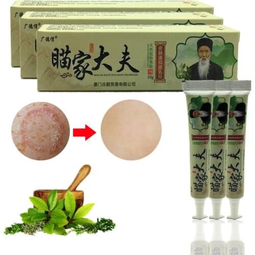 Skin Psoriasis Cream Dermatitis Eczematoid Eczema Ointment Treatment Psoriasis Cream Skin Care Cream
