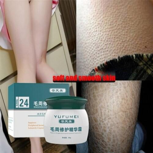 Curing Keratosis Pilaris/ KP/ Chicken Skin Body Lotion Skin Repair Cream 50g