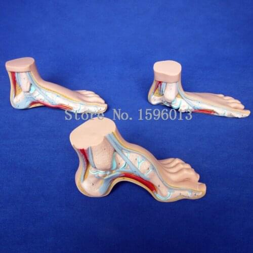 Normal foot, Flat foot, Arched Foot Model 19 parts marked, Anatomical Foot Model