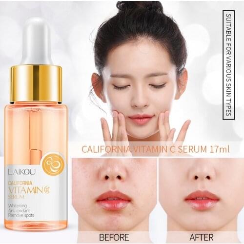 17ML Vitamin C Whitening Facial Serum Remove Dark Circles Fade Freckles Spots Melanin Moisturizing Brightening Face Essence