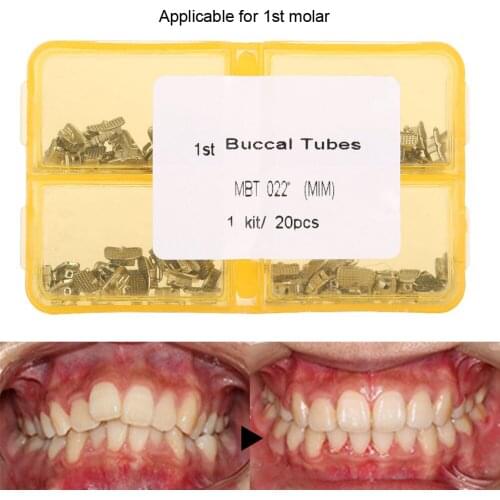 20Set/Bag Dental Orthodontic Tube Stainless Steel 1st Molar Roth Single Buccal Tube Smooth Surface Does Not Damage Oral Mucosa