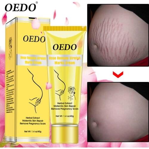 Rose Remove Pregnancy Scars Acne Cream Stretch Marks Treatment Maternity Repair Anti-Aging Anti-Winkles Firming Body Creams