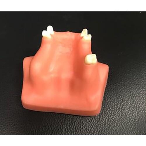 Resin Simulated Dental Tooth Module Teeth Dental Teaching Model Dentist Oral Tooth Planting Training Practice Instrument Tools