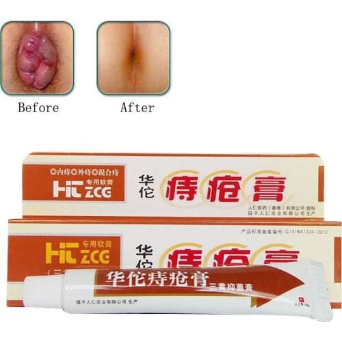 Hua Tuo Hemorrhoids Ointment Vietnam Hemorrhoids Cream Painkiller Pain Relief External Anal Fissure Medical Plaster