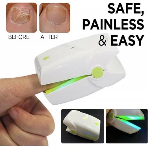 Cold Laser Nail Fungus Therapy Device Professional Toe Finger Nail Fungal Infection Laser Treatment Machine