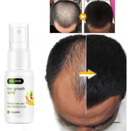 20ML Ginger Hair Growth Serum Hair Loss Treatment Spray Effective Germinal Hair Growth Essential Oil Men Women Hair Care
