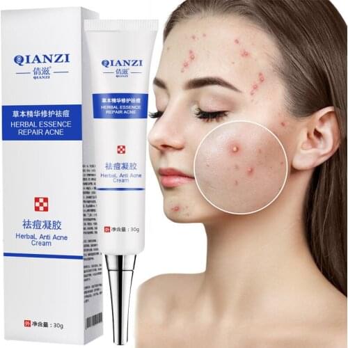 Acne Removal Cream Acne Treatment Blackhead Repair Oil Control Shrink Pores Scars Whitening Moisturizing Acne Cream Skin Care
