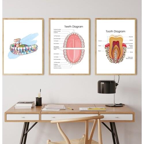 Tooth Implant Art Dental Crown Print Dentist Gift Tooth Anatomy Medical Wall Art Canvas Painting Picture Dental Clinic Decor