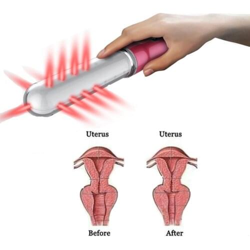 Home Use Vaginal Tightening Machine for Rejuvenate Vagina Laser Therapy for Vaginitis Treatment Female Health Care