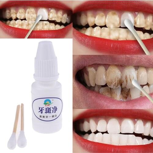 10ml Teeth Whitening Water Oral Hygiene Cleaning Teeth Care Tooth Cleaning Whitening Water Clareamento Dental Odontologia Hot