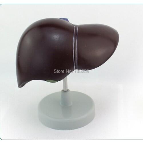 Human Liver Model,Liver Anatomical Model,Porta Hepatic Gallbladder Bile Duct Structure Model