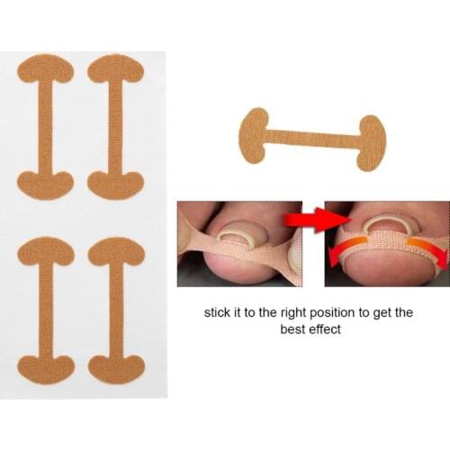 Effiective Toe Nail Corrector Deformation Meat Bag Ingrown Toenail Tool Orthodontic Thumb Nail Roll Patch Foot Care Device