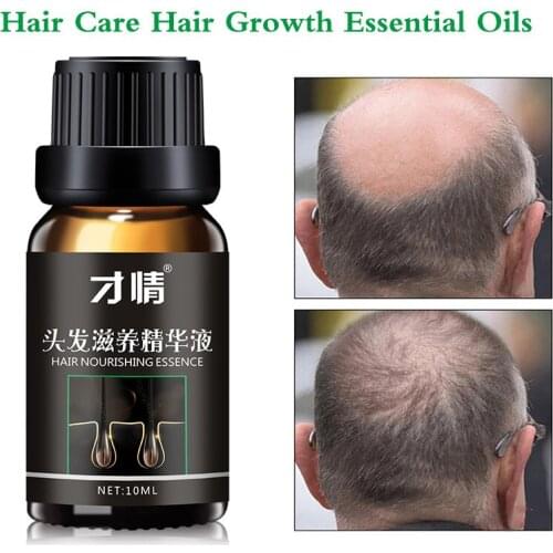 Hair Growth Product Essential Oil Anti-Hair Loss Treatment for Man Woman Nourish Strengthen Hair Roots Repair Dry Hair Split 10g