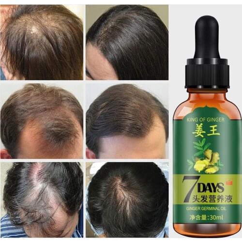 Hair Care Hair Growth Essential Oils Essence Original Authentic 100% Hair Loss Liquid Health Care Beauty Dense Hair Growth Serum