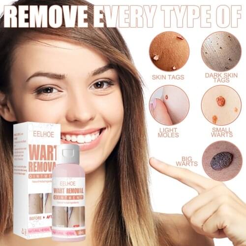 EELHOE Wart Treatment Cream Warts Remover Antibacterial Ointment Skin Tag Remover Corn Plaster Warts Ointment Skin Care