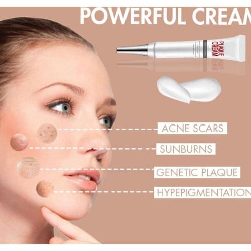 Effective Whitening Freckle Cream Remove Acne Spot Pigment Melanin Dark Spots Pigmentation Lasting Moisture Gel Skin Care TSLM1