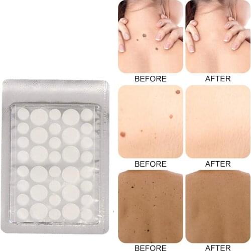 Hot Skin Tag Remover Patch Natural Ingredients Improved Formulation Skin Tag Remover Covers and Conceals Skin Tags Tags Dries