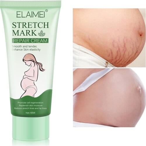 Remove Pregnancy Scars Acne Cream Stretch Mark Treatment Maternity Repair Anti-Aging Anti-Winkle Firming Body Cream 60ML