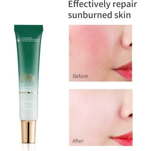 High Quality Aloe Vera Gel Soothing Moisturizer Lotion Sunburn Relief Hydrating Soften Match Any Skin Stypes for Face