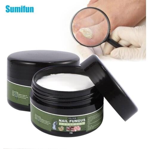 1Pcs 20g Herbal Nail Repair Cream Paronychia Onychomycosis Treatment Antibacterial Ointment Anti-Infection Finger Care Plaster