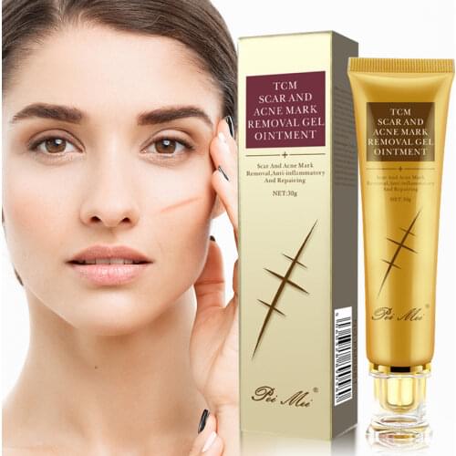 Acne Scar Removal Cream Pimples Stretch Marks Face Gel Remove Acne Smoothing Whitening Moisturizing Body Skin Care Aichun 30g