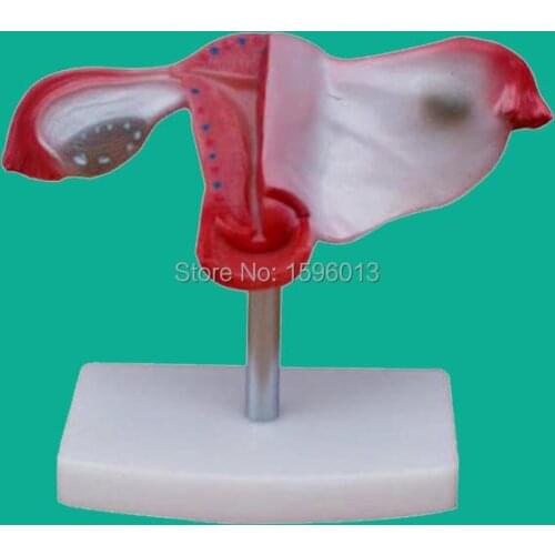 Natural Uterus Model, Economic Anatomical Uterus Model