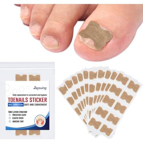 100pcs/10Sheets Ingrown Toenail Corrector Sticker Paronychia Treatment Pedicure Toe Nail Care Corrector Patch Correction Sticker