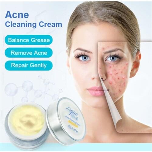 AUQUEST 15g Pure Natural Acne Cleaning Face Cream Rejuvenation Whitening Remove Acne Exfoliation Oil Control Face Skin Care