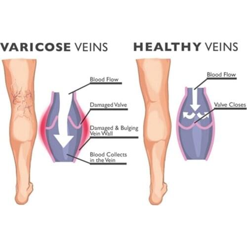 6 pair/set Nylon Anti-Fatigue Knee High Compression Socks Calf Foot Support Stockings S-XXL Mens Womens socks f