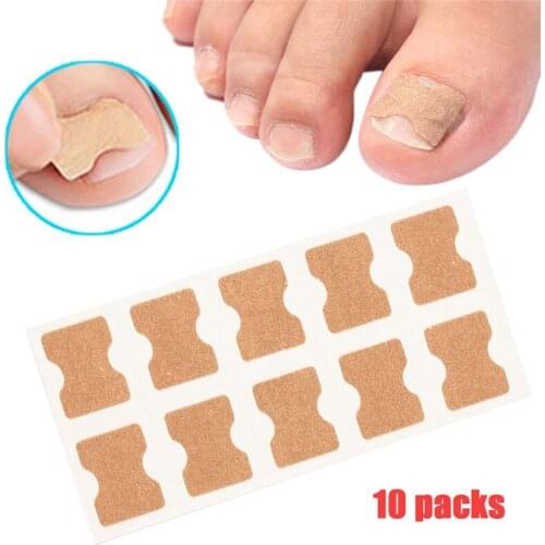 2/5Pcs Nail Ingrown Correction Sticker Treatment Paronychia Correction Pedicure Elastic Force Sticker Pedicure Foot Care Tool