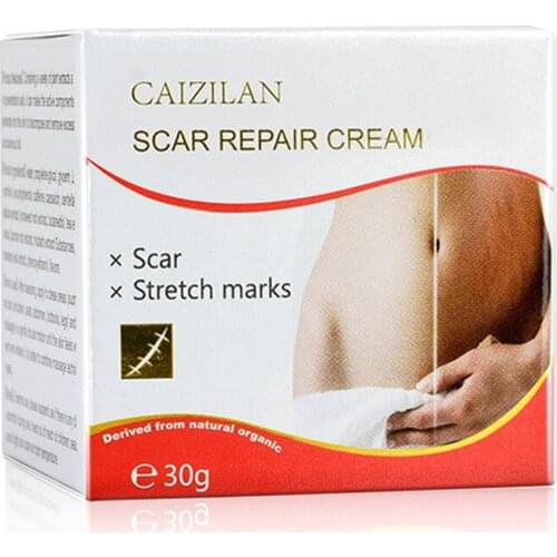 Skin Creams Remove Pregnancy Scars Acne Cream Stretch Marks Treatment Mater Body Smoothing Whitening Skin Care TSLM1