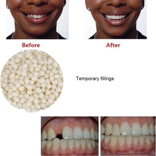 50g *2 Bag False Teeth Solid Glue Temporary Tooth Repair Gaps Filling Denture Adhesive Teeth Whitening Oral Care Supplies