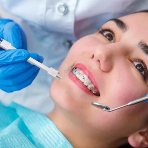 1pcs Dental Brackets Gauge Locator Stainless Steel Rod Dental Orthodontic Positioner Teeth Instruments Tool Oral care