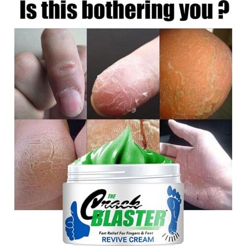 Crack Blaster Revive Cream Anti-Drying Crack Foot Cream Heel Cracked Repair Cream Removal Dead Skin Hand Feet Care 15g