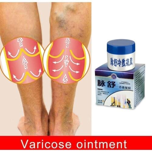 Herbal Medicine For Treating Varicose Vasculitis Phlebitis Treat Spider Vein Varicose Pain Massage Veins Cream Ointment Leg Z3F9