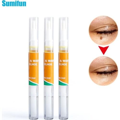 1pcs Skin Tag Remover Cream Against Mole & Genital Wart fast Remover Anti Foot Corn Removal Papillomas Rapidly removes mole