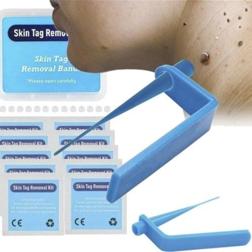 1 Set Home Use Skin Tag Kill Skin Mole Wart Remover Micro Band Removal Kit With Cleansing Swabs Adult Mole Wart Face Care Tool