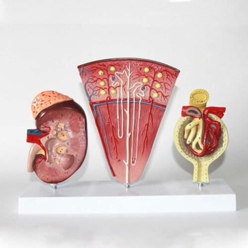 Life Size 3 Pcs Kidney and Urinary System Model Adrenal Gland Nephron Model Glomerular Renal Anatomy Model Kidney Cross Section