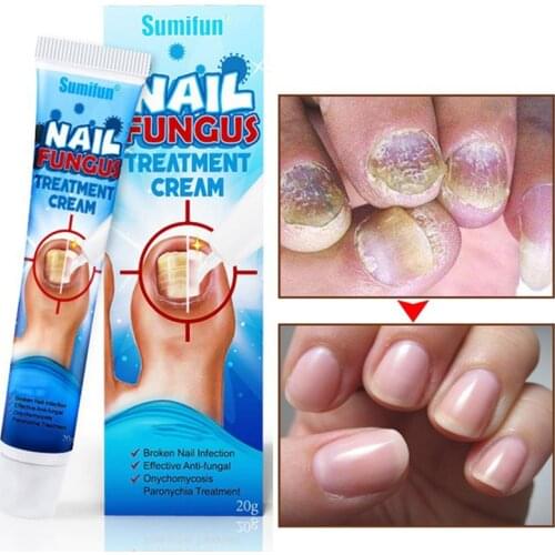 ROSOTENA Foot Care Products